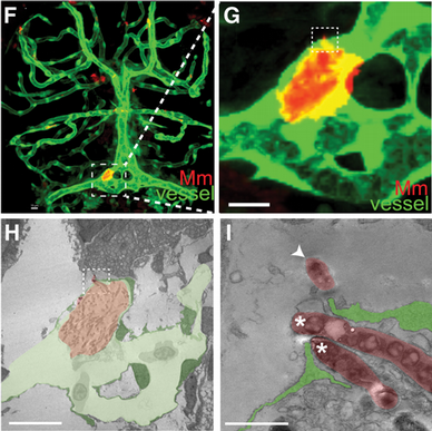 Correlative Light and Electron Microscopy Zebrafish