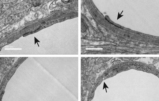 PLX5622 and effects on microglia