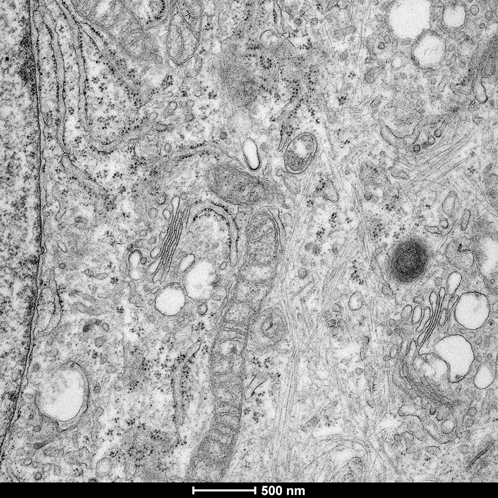 7 of 7, ER Golgi Mitochondria cytoskeleton