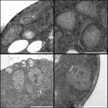 inner-mitochondria.jpg